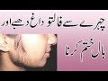 Remove Face Hair Tips In Urdu - Face Hair Removal natural beauty Tips In Urdu/Hindi
