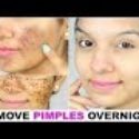 Top 10 amazing beauty tips for instant wightening your face and remove black spots