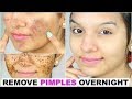 Top 10 amazing beauty tips for instant wightening your face and remove black spots