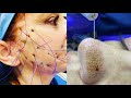 Extreme Smart and Helpful Beauty Treaments, Makeup Tricks and More!